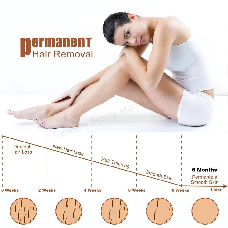 FEMUN 4000W Ice Cooling Diode Laser Hair Removal Device 755 940 1064 808nm